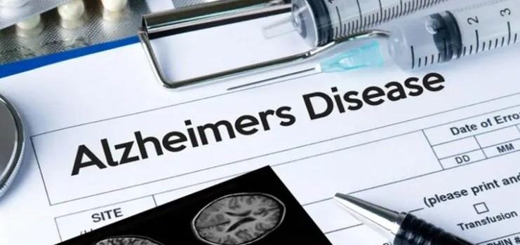 Lanzan al mercado la primera prueba de Alzheimer