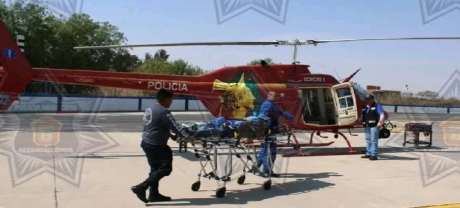 Menor se quemó con pirotecnia en Los Reyes La Paz; fue trasladado vía aérea a hospital de la Cdmx