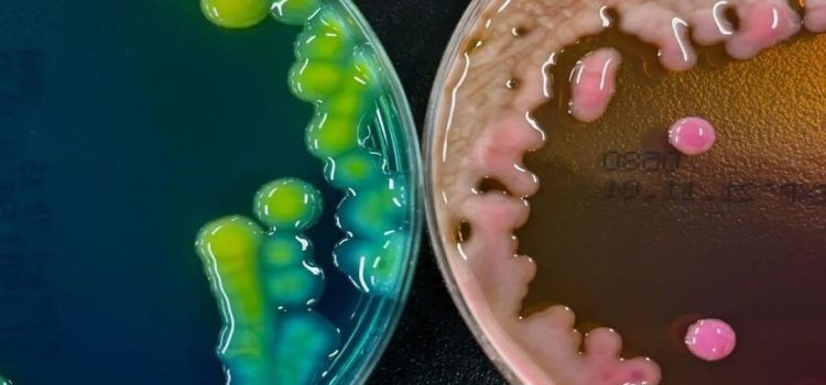 Emiten alerta epidemiológica por brote de bacteria Klebsiella oxytoca en Edomex