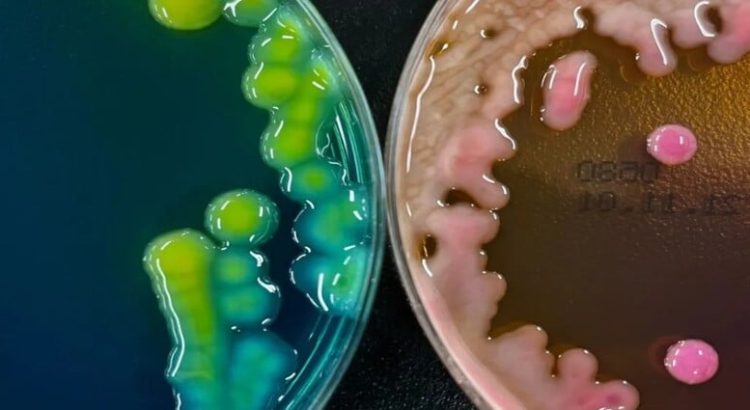 Emiten alerta epidemiológica por brote de bacteria Klebsiella oxytoca en Edomex